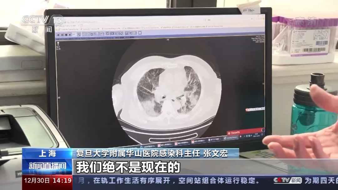 为什么感觉“白肺”变多了？专家解答！上海现殡葬“黄牛”，警方出手，多名殡葬“黑中介”也栽了